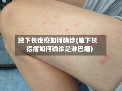 腋下长疙瘩如何确诊(腋下长疙瘩如何确诊是淋巴瘤)