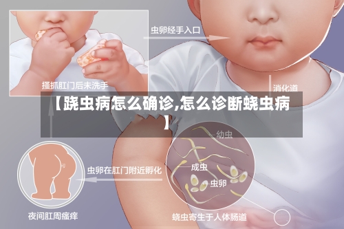 【跷虫病怎么确诊,怎么诊断蛲虫病】