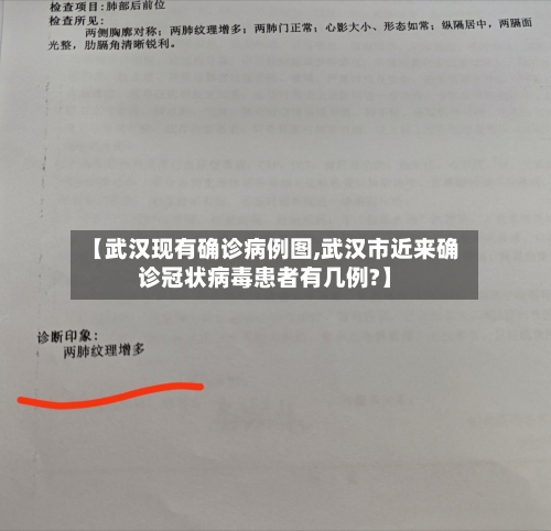 【武汉现有确诊病例图,武汉市近来确诊冠状病毒患者有几例?】