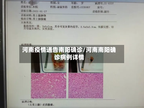 河南疫情通告南阳确诊/河南南阳确诊病例详情