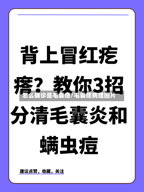 怎么确诊是毛囊痣/毛囊痣病理图片