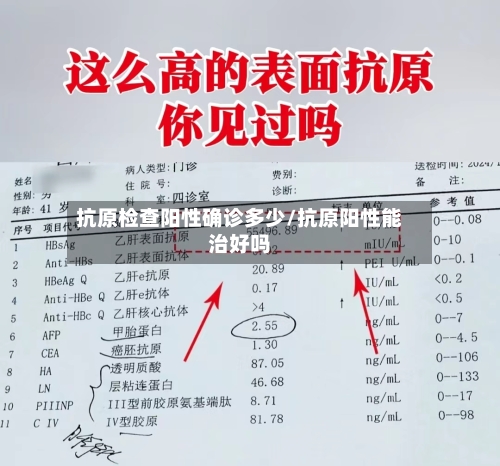抗原检查阳性确诊多少/抗原阳性能治好吗