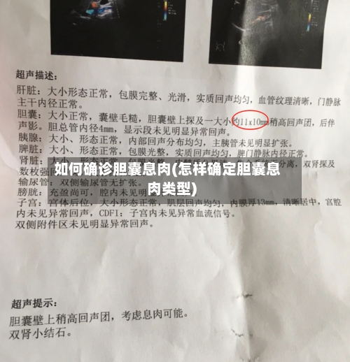 如何确诊胆囊息肉(怎样确定胆囊息肉类型)