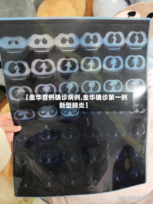 【金华首例确诊病例,金华确诊第一例新型肺炎】