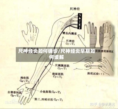 尺神经炎如何确诊/尺神经炎早期如何缓解