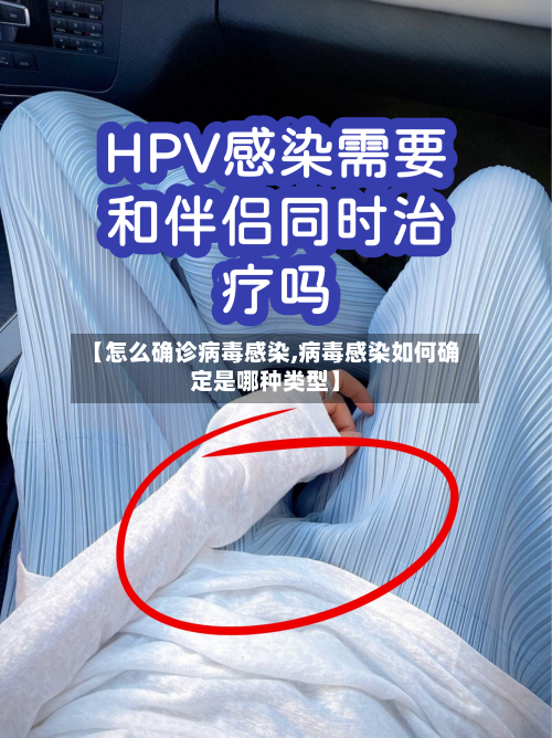 【怎么确诊病毒感染,病毒感染如何确定是哪种类型】