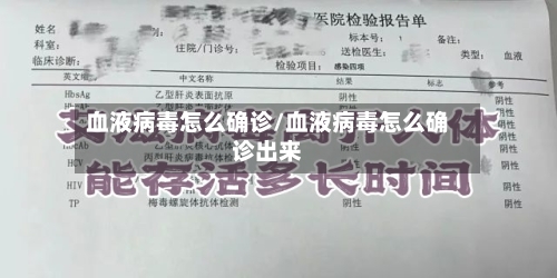 血液病毒怎么确诊/血液病毒怎么确诊出来