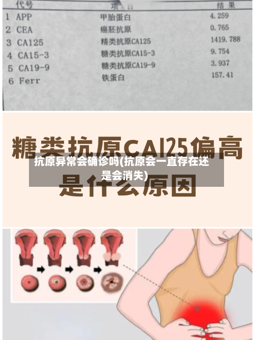抗原异常会确诊吗(抗原会一直存在还是会消失)