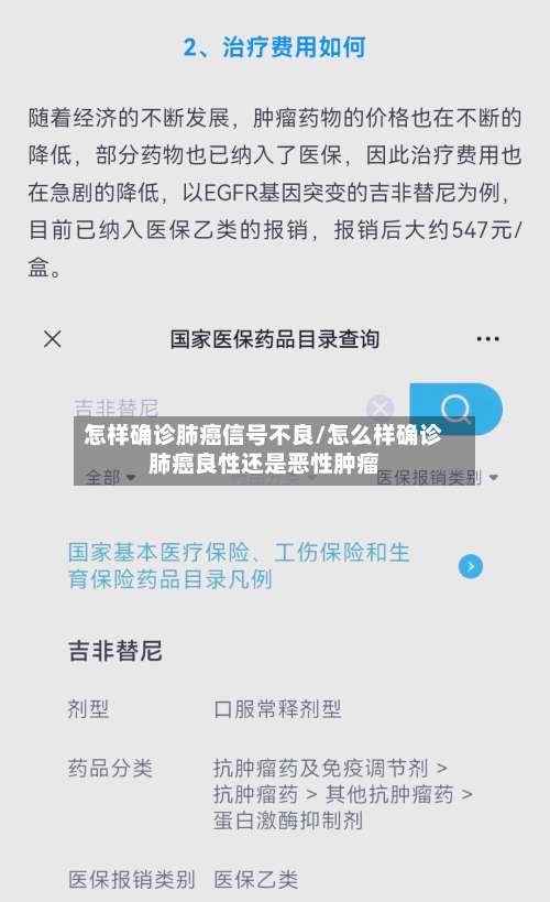 怎样确诊肺癌信号不良/怎么样确诊肺癌良性还是恶性肿瘤