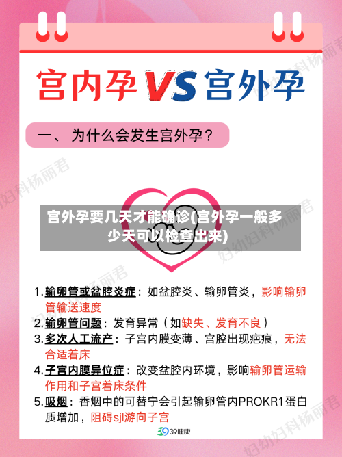 宫外孕要几天才能确诊(宫外孕一般多少天可以检查出来)
