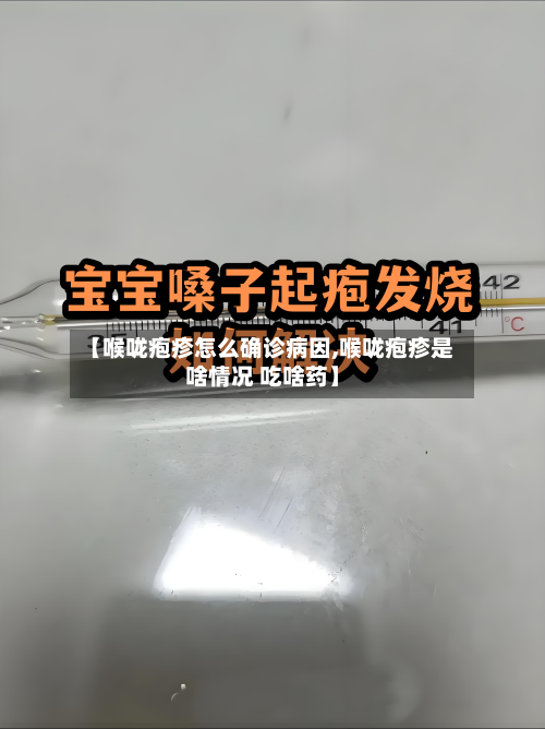 【喉咙疱疹怎么确诊病因,喉咙疱疹是啥情况 吃啥药】