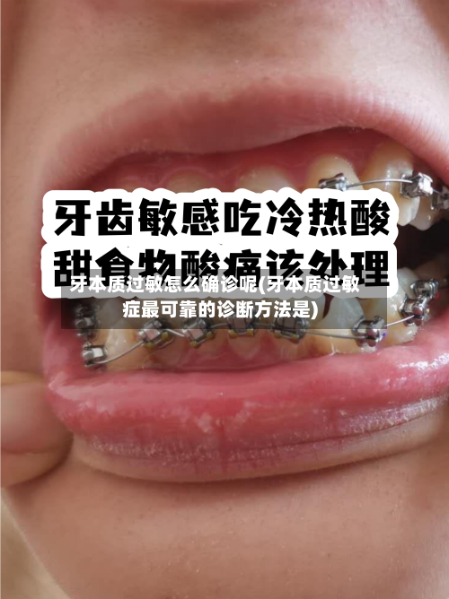 牙本质过敏怎么确诊呢(牙本质过敏症最可靠的诊断方法是)