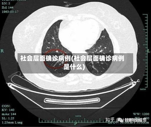 社会层面确诊病例(社会层面确诊病例是什么)