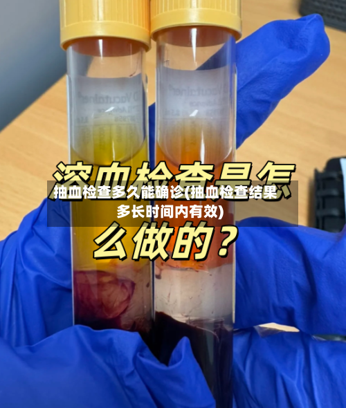 抽血检查多久能确诊(抽血检查结果多长时间内有效)