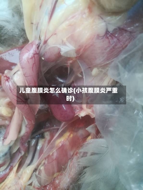 儿童腹膜炎怎么确诊(小孩腹膜炎严重时)