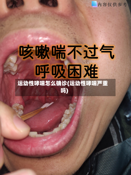 运动性哮喘怎么确诊(运动性哮喘严重吗)