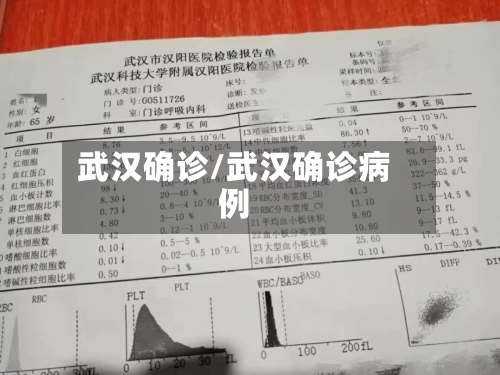 武汉确诊/武汉确诊病例