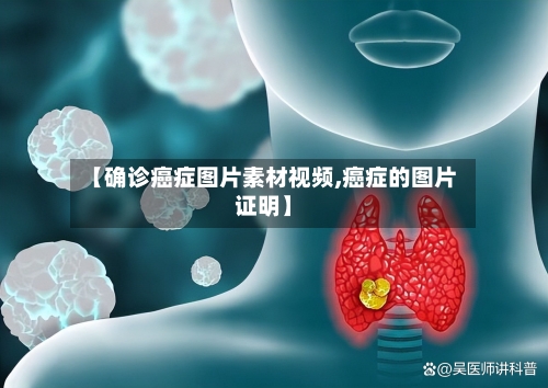 【确诊癌症图片素材视频,癌症的图片证明】