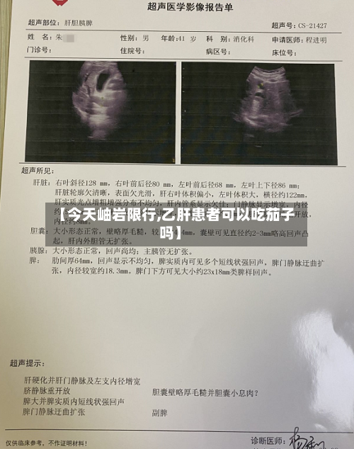 【今天岫岩限行,乙肝患者可以吃茄子吗】
