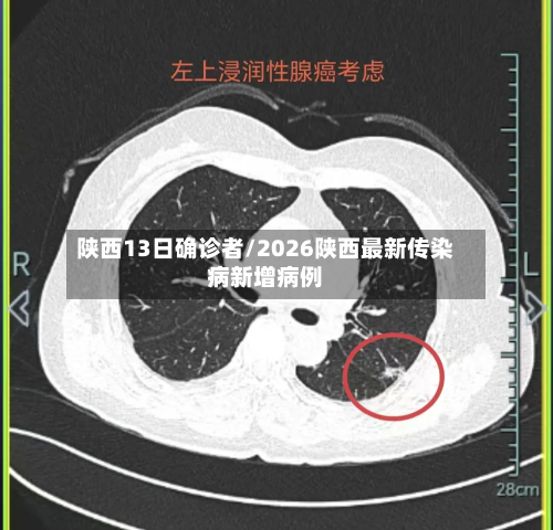 陕西13日确诊者/2026陕西最新传染病新增病例