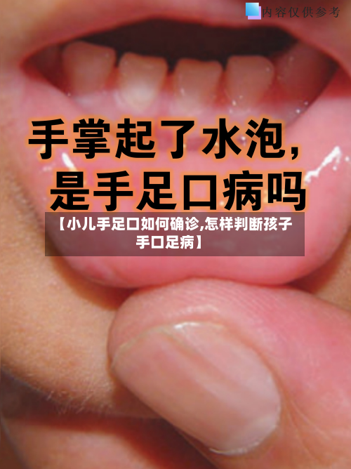 【小儿手足口如何确诊,怎样判断孩子手口足病】