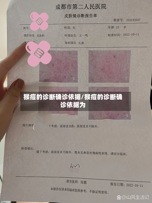 猴痘的诊断确诊依据/猴痘的诊断确诊依据为