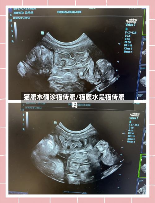 猫腹水确诊猫传腹/猫腹水是猫传腹吗
