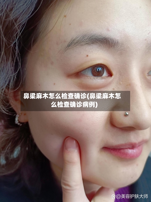 鼻梁麻木怎么检查确诊(鼻梁麻木怎么检查确诊病例)