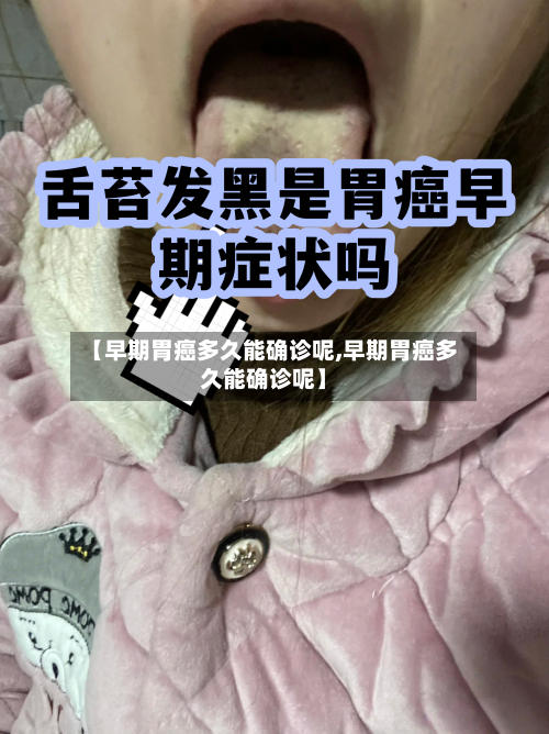 【早期胃癌多久能确诊呢,早期胃癌多久能确诊呢】