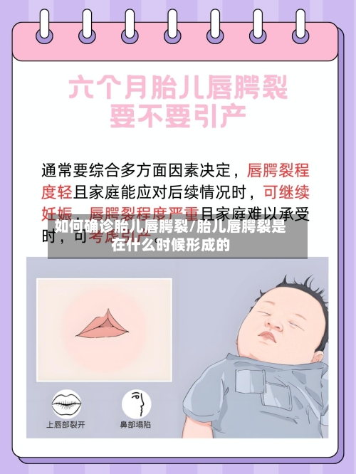 如何确诊胎儿唇腭裂/胎儿唇腭裂是在什么时候形成的