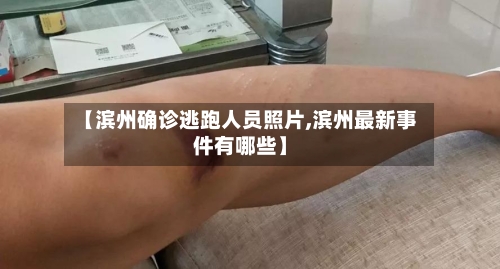 【滨州确诊逃跑人员照片,滨州最新事件有哪些】