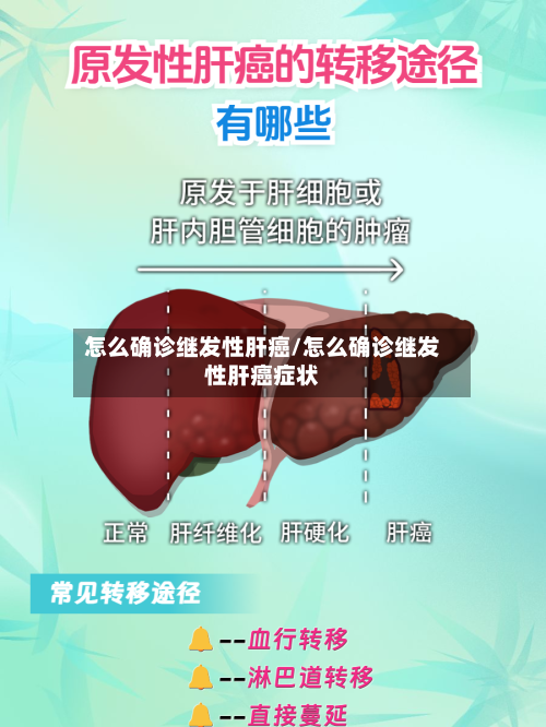 怎么确诊继发性肝癌/怎么确诊继发性肝癌症状