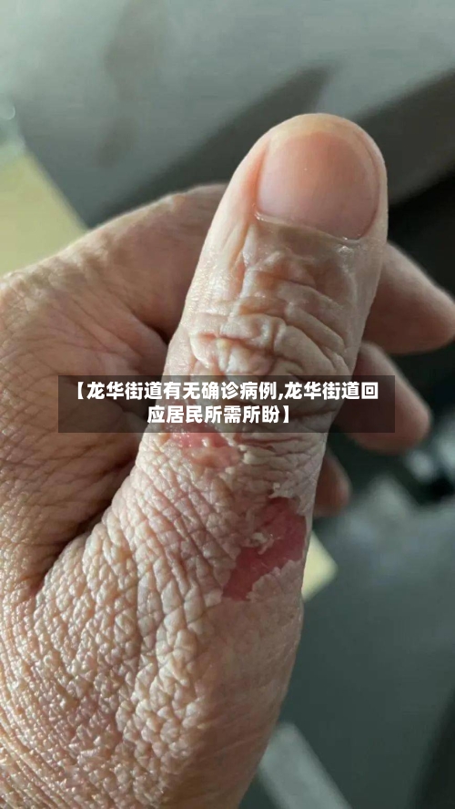 【龙华街道有无确诊病例,龙华街道回应居民所需所盼】