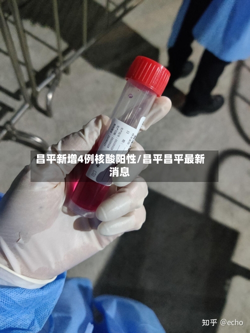 昌平新增4例核酸阳性/昌平昌平最新消息