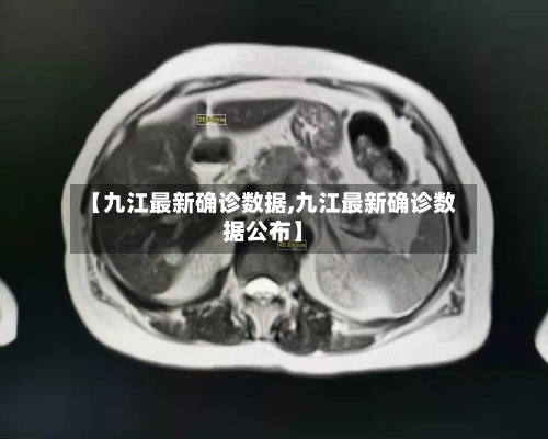 【九江最新确诊数据,九江最新确诊数据公布】